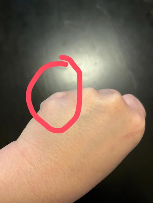 小拇指短代表什么?