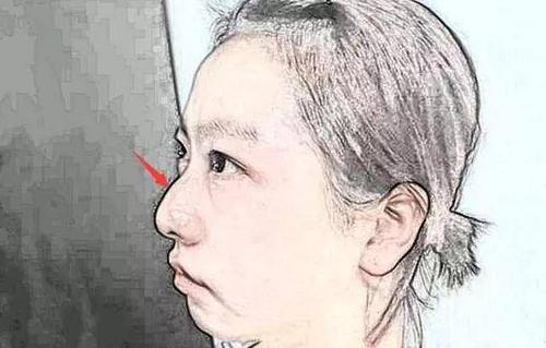 事业大起大落的人鼻子特征