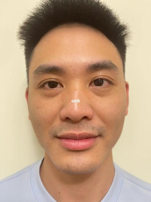 男生有法令纹代表着什么意思