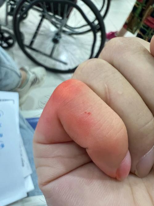 梦见梦见孩子被老鼠咬