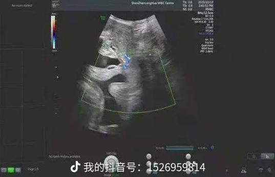 佛说意外怀孕的孩子都有灵性