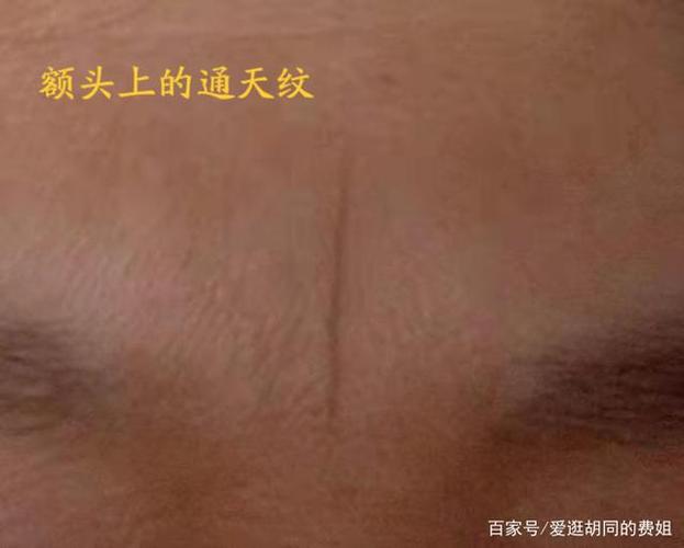 额头上的通天纹长什么样