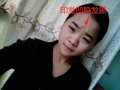 生病了对工作还有热情的面相