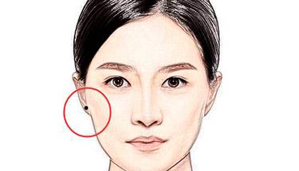 女性横财痣 耳珠有痣富上加富