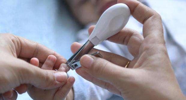 手指甲可以做亲子鉴定吗