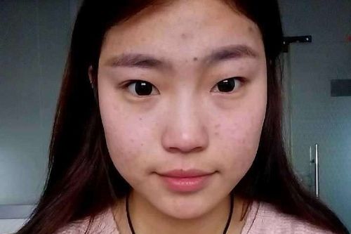 人脸上的印堂发黑该怎么办?