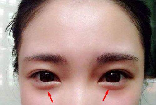为什么说女人有卧蚕是一种难得的好面相