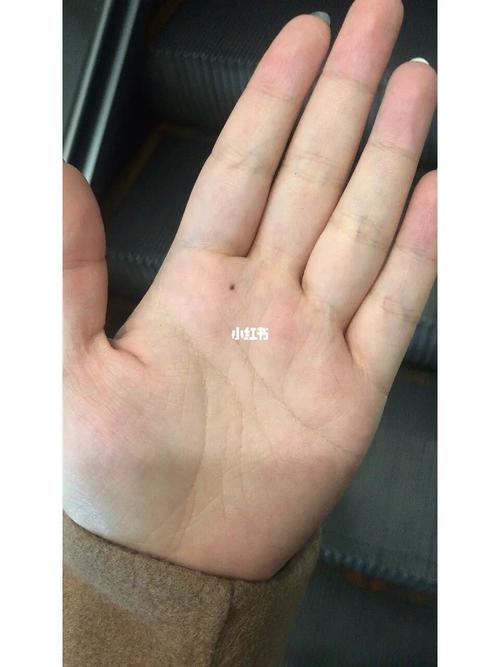 女孩手心长痣好不好?有轮回之说?
