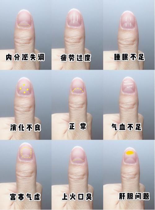 教你从指甲形状看情感状况