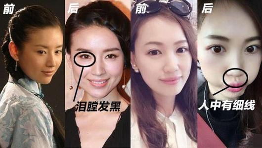 人中弯曲的女人是不是容易出轨
