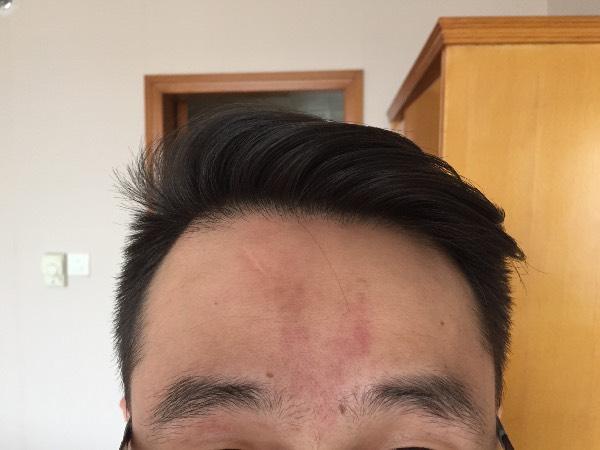 男人印堂发红好不好