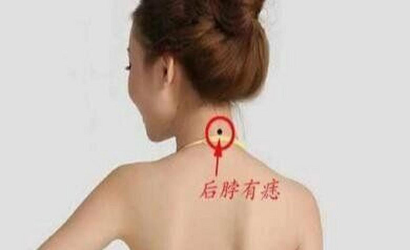 女生后颈左边有痣意味着什么