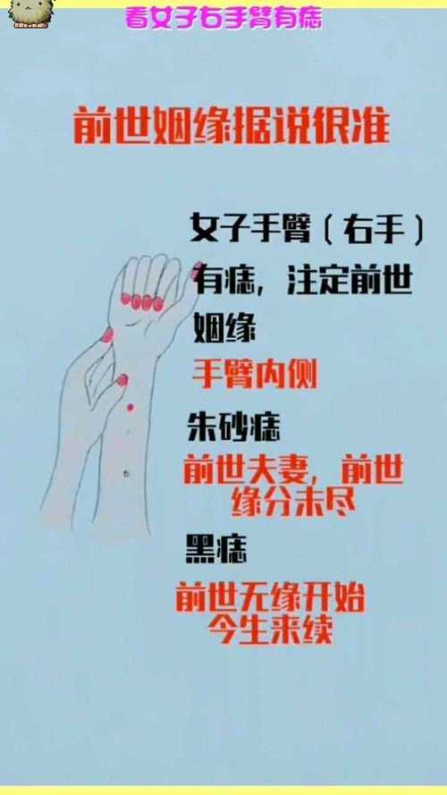 前世姻缘痣 前世姻缘痣手臂