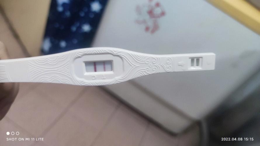 妊娠线什么时候明显,颜色会越变越深?