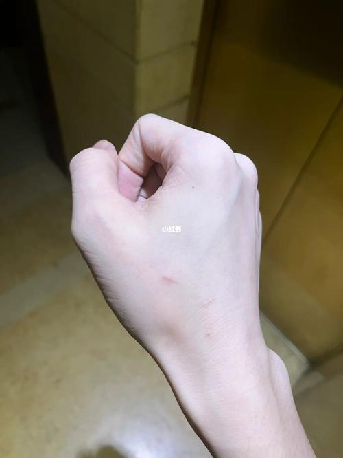 梦到被猫咬手不放什么征兆