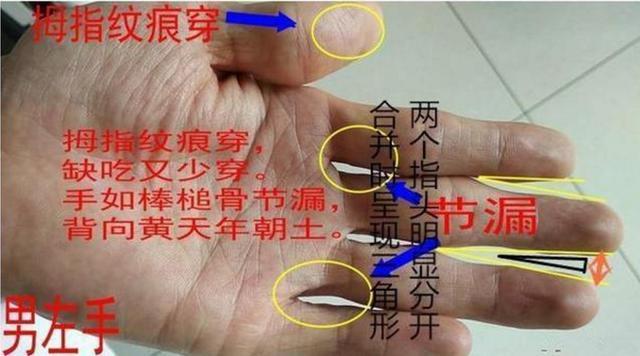 解析手掌中有口字纹的人命理状况