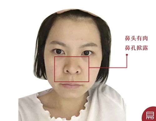 女人鼻孔外露面相
