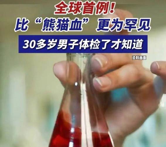 熊猫血的人好不好
