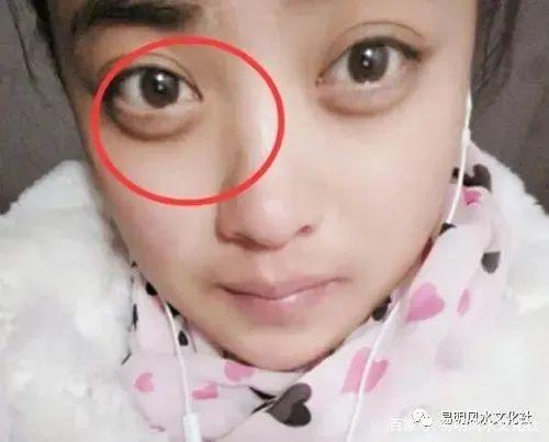 死鱼眼面相的女人怎么样