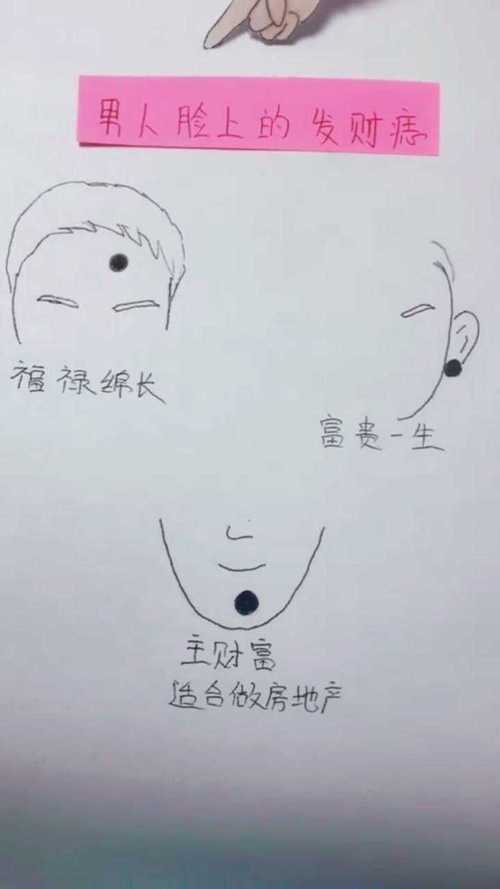 男人发财痣 有何说法