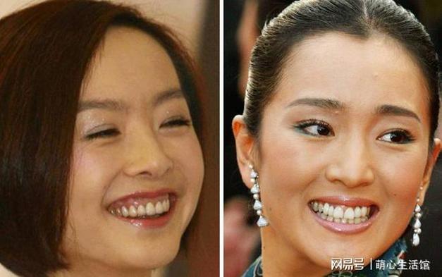 30多岁掉牙齿是什么预兆