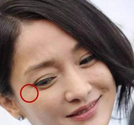 额头有疤的女人面相好吗?