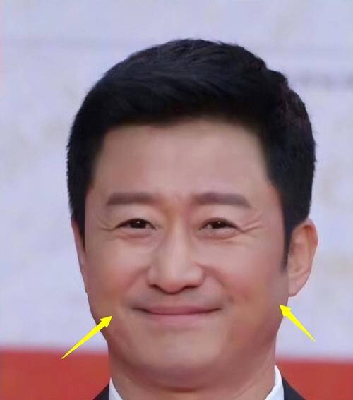 腮骨外翻的人非常看重个人利益吗