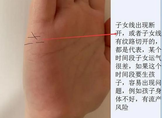 命中有无子女测算