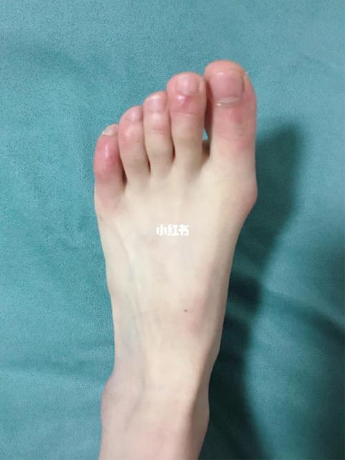 食指比大拇指长的脚是什么命