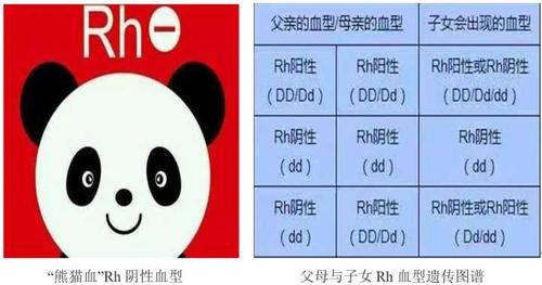 熊猫血型是什么型号