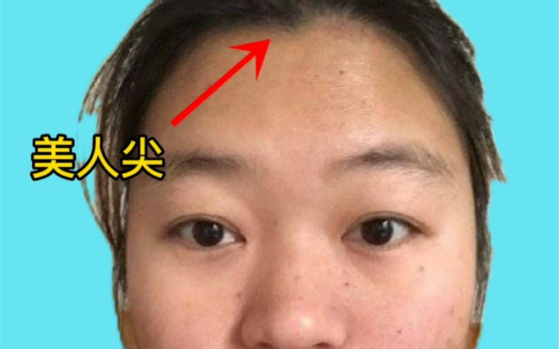 额头尖是上等人面相吗