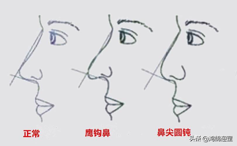 鹰钩鼻面相解析