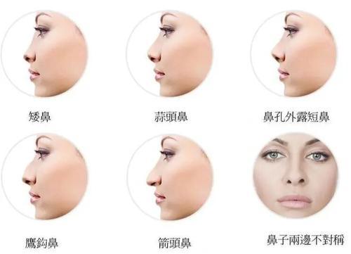 什么是孩童鼻,孩童鼻女人面相解读
