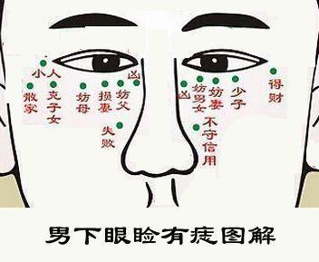 男人旺妻痣长在哪里