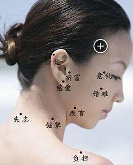 脖子后面有痣是压运痣是真的吗 代表着什么