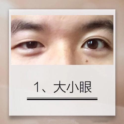 男人双眼皮代表什么命