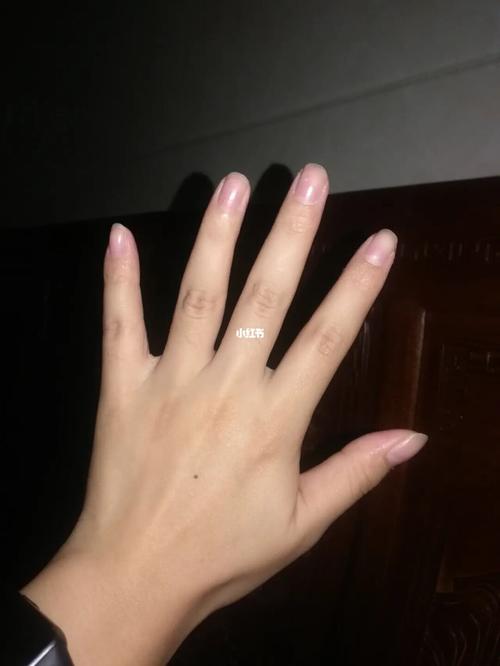 圆锥手是什么样子的手型