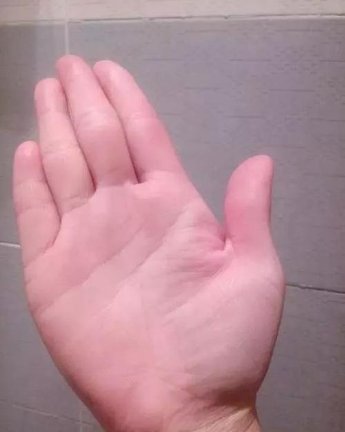 尾指短的女人的命运如何