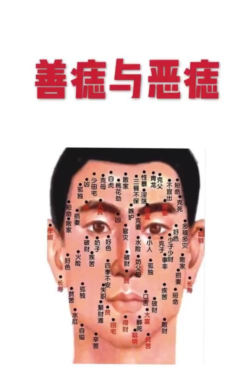 善痣和恶痣的区别是什么