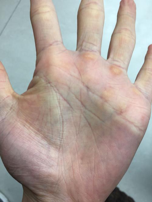 智慧线行走上的异变有哪些？
