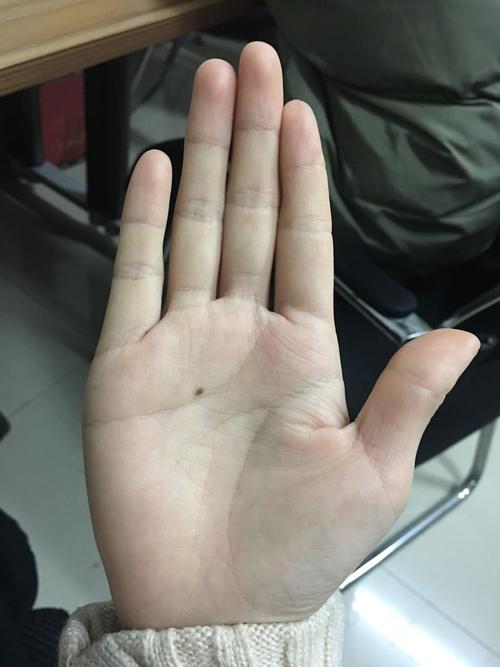 掌心有痣是什么的标志