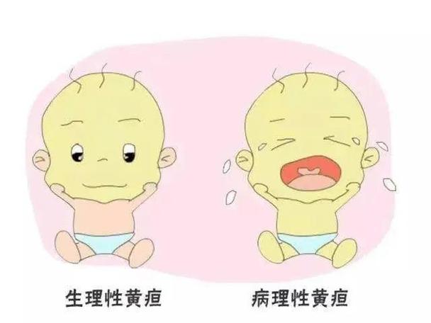 梦见黄疸病