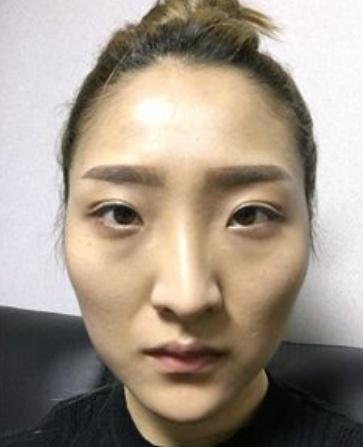 窄额头高颧骨面相怎么样