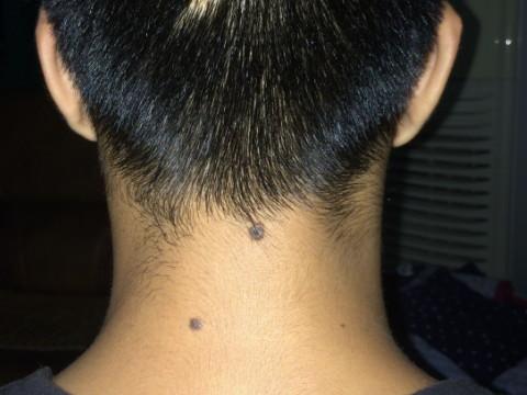 苦情痣的男人婚姻好吗