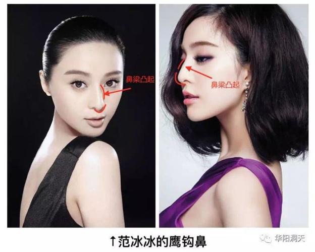女人鹰钩鼻好不好