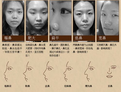 面相上鼻孔朝天的人说明什么