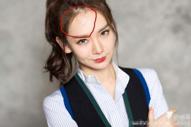额头有疤痕的女人感情生活顺利吗