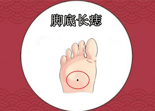 面相脚底有痣贵人之相