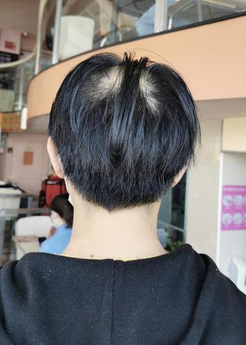 女人很早就秃头在相术上有什么弊端