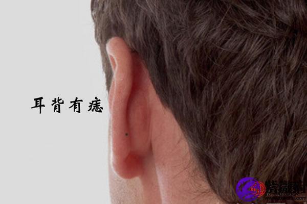 男人痣相,耳背有痣的男人物质生活富裕吗